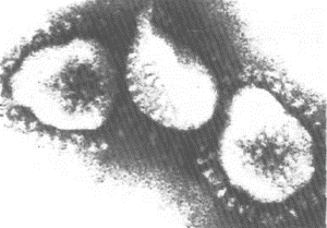 Інфекційний бронхіт у курей відомий також, як ІБК, Infectious bronchitis, Bronchitis infectiosa avium