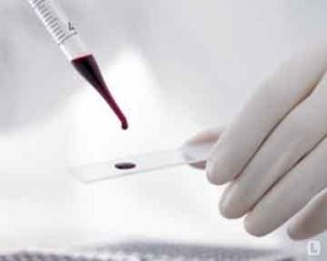 Клітинний параліч у домашньої птиці: поразка в будь якому віці