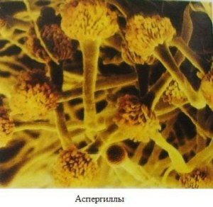 Аспергільоз птахів: поразка серзной оболонки і дихальної системи