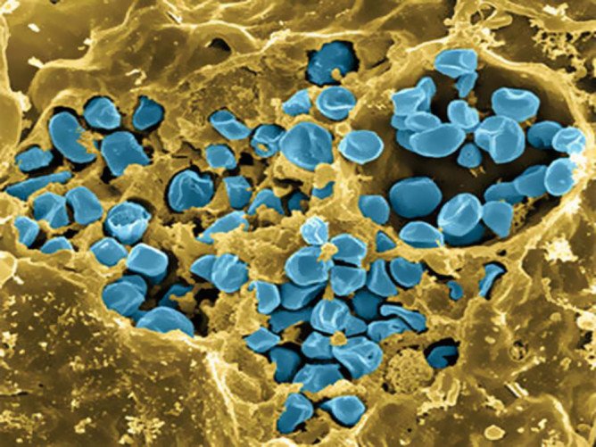 Які хвороби переносять кліщі і чим вони небезпечні для людини