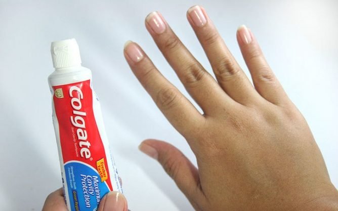 Кошти від укусів комарів: чим мазати щоб укус не свербів