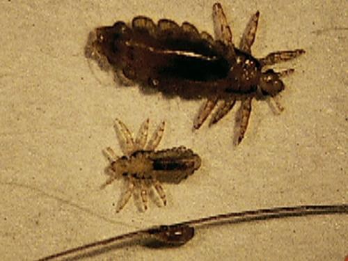 Воші – інкубаційний період і способи зараження