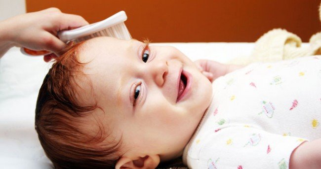 Як вивести вошей у дитини в домашніх умовах — лікування для самих маленьких Як вивести вошей у дитини в домашніх умовах — лікування для самих маленьких