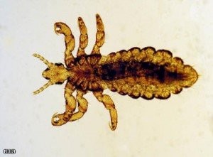 Як виглядають блохи: як відрізнити їх від вошей і гнид