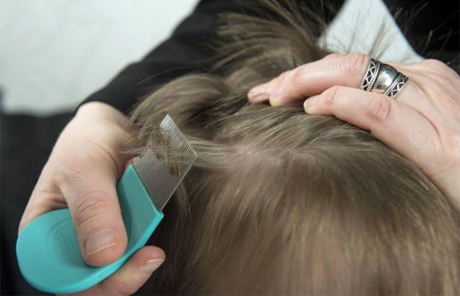 Воші у дітей: Лікування в домашніх умовах — позбавляємося Назавжди