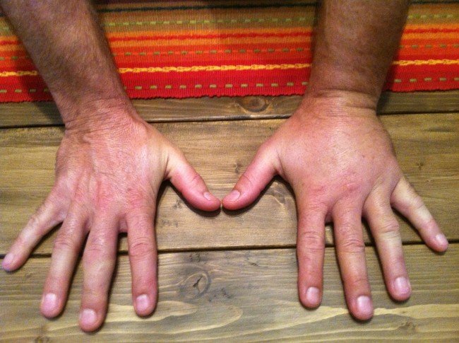 Укус оси: Чим небезпечний і як мінімізувати наслідки