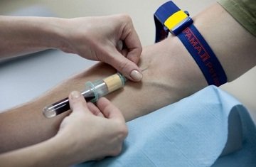 Які негативні наслідки для людини від укусу кліща? Зараження симптоми енцефаліту, хвороби Лайма