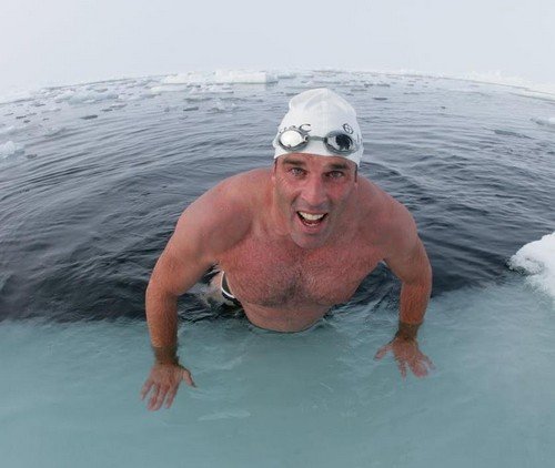 При якій температурі гинуть воші і їх личинки?