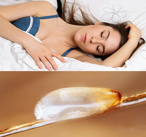 До чого сняться воші – калейдоскоп найпопулярніших сонників