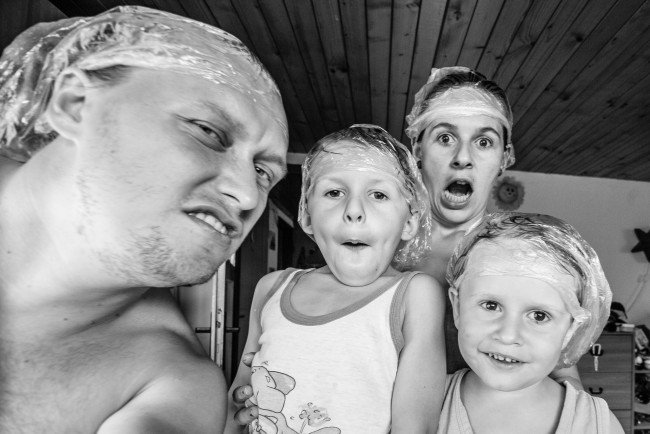 Чому воші небезпечні для людини — Як правильно від них позбавлятися