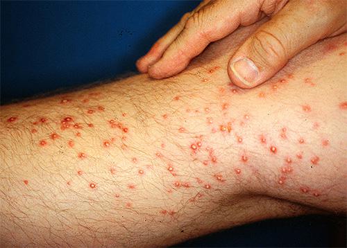 Червоні мурахи: зовнішній вигляд, спосіб життя і середовище проживання