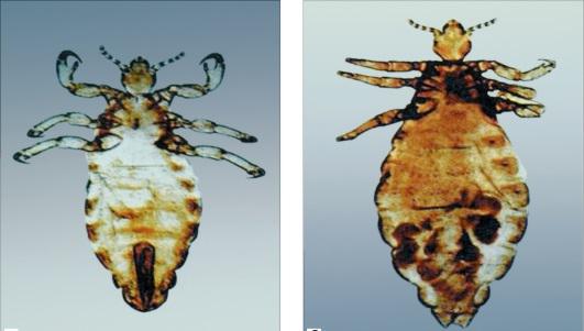 Як розмножуються воші   особливості статевого та життєвого циклу