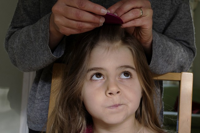 Як позбутися від гнид: личинки вошей у волоссі — що робити?