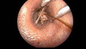 Чим небезпечні таргани: кусаються чи, може тарган залізти в вухо