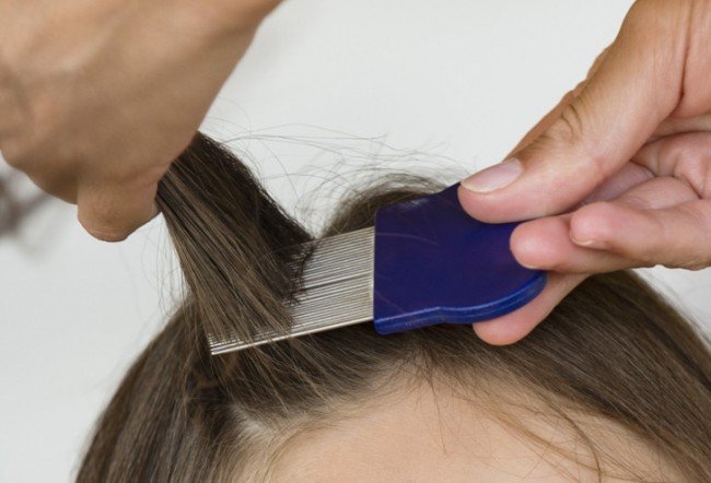 Як вивести вошей у дитини в домашніх умовах — лікування для самих маленьких Як вивести вошей у дитини в домашніх умовах — лікування для самих маленьких