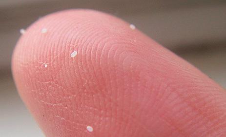 Блохи у кішок і методи позбавлення від них