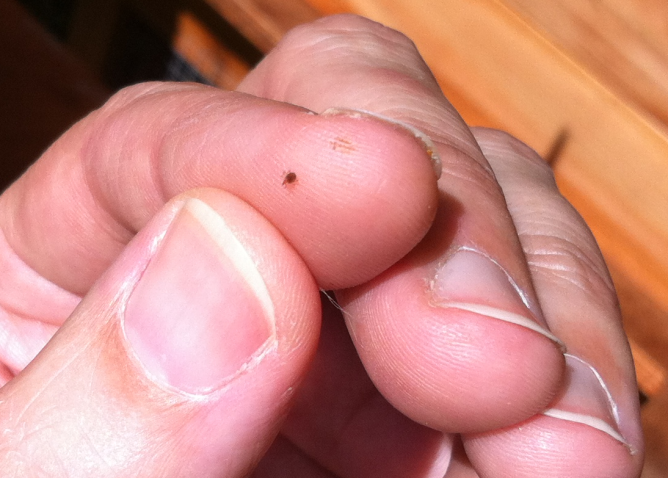 Курячий кліщ і наскільки він небезпечний для людини