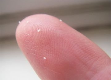 Пацюча блоха: опис, розмноження, заходи боротьби, допомога при укусах