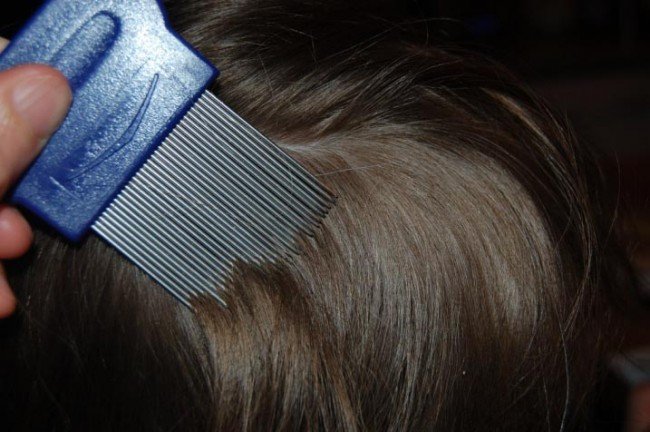 На допомогу прийде шампунь від гнид і вошей — Лікуємо педикульоз ефективно