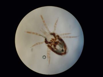 Гамазовые кліщі   як позбавиться від небезпечних кровосисних