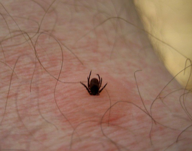 Лісовий кліщ   що це таке і як від нього захиститися