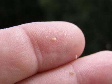 Гниди і довге волосся: вирішення проблеми і заходи профілактики