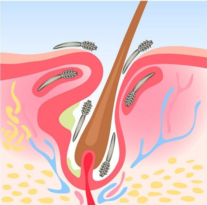 Підшкірні і шкірні кліщі: як визначити, симптоми