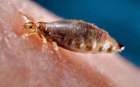 Людська воша і її різновиди