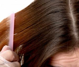 Головна воша: симптоми, причини появи, лікування