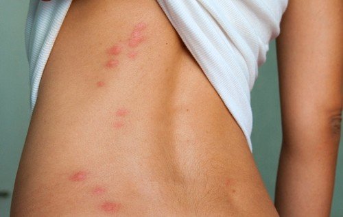 Клопи у квартирі – місця проживання та ознаки появи