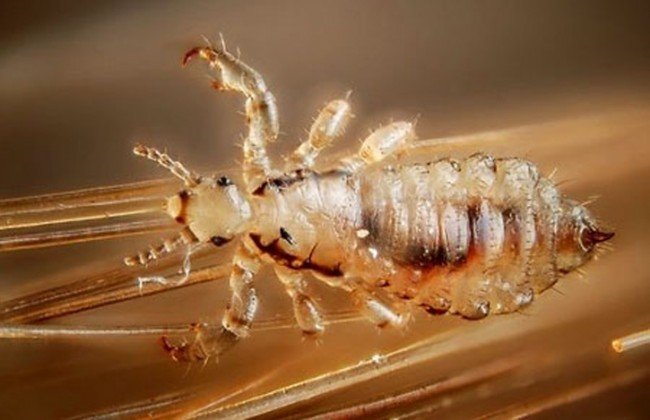 Педикульоз або як вивести вошей — перевірені поради