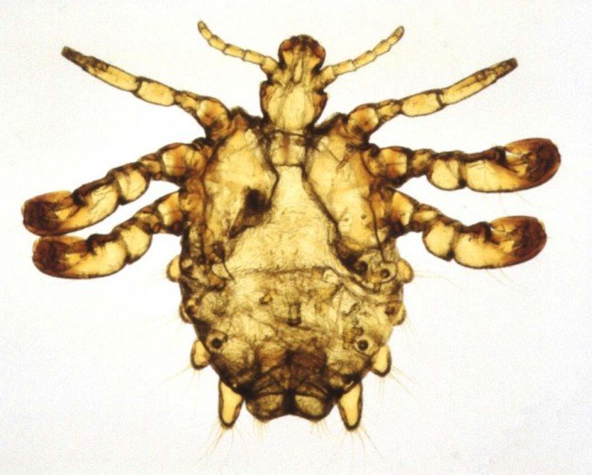 Як виглядає вша — збільшені фото представників сімейства