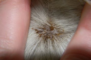 Вошей на голові людини