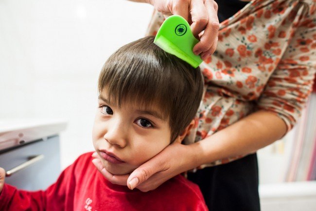 Воші: що робити, якщо заразилася дитина — як перемогти заразу? Воші: що робити, якщо заразилася дитина — як перемогти заразу?