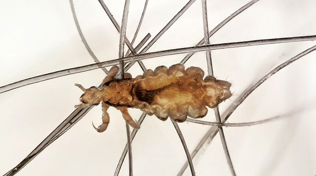 Скільки Воші живуть серед нас — Як убезпечити себе і дітей