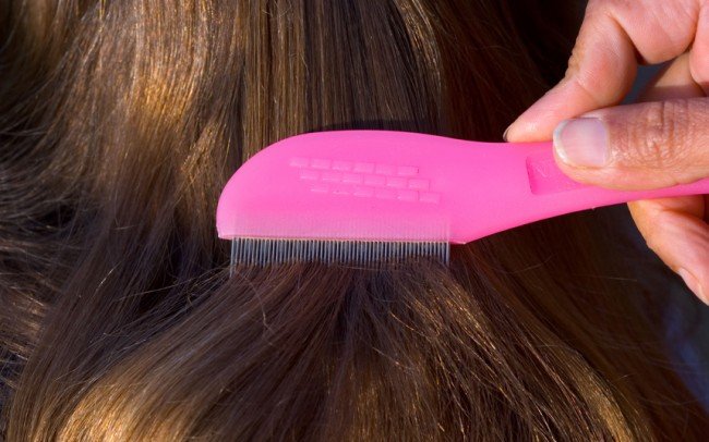 Гниди у дитини: чим небезпечні і як швидко лікувати !?