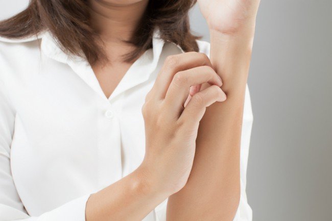 Педикульоз або як вивести вошей — перевірені поради