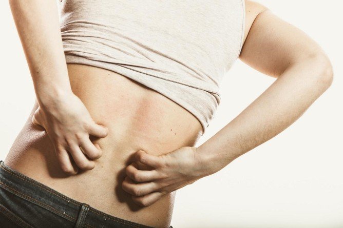 Звідки беруться постільні клопи і як розмножуються