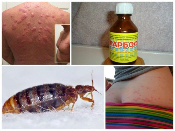 Засіб від клопів в домашніх умовах; засоби проти клопів