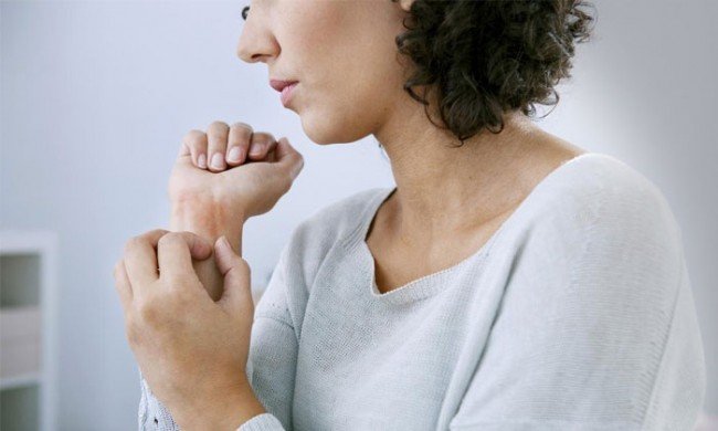 Як позбавитися від блох — ефективні та перевірені способи