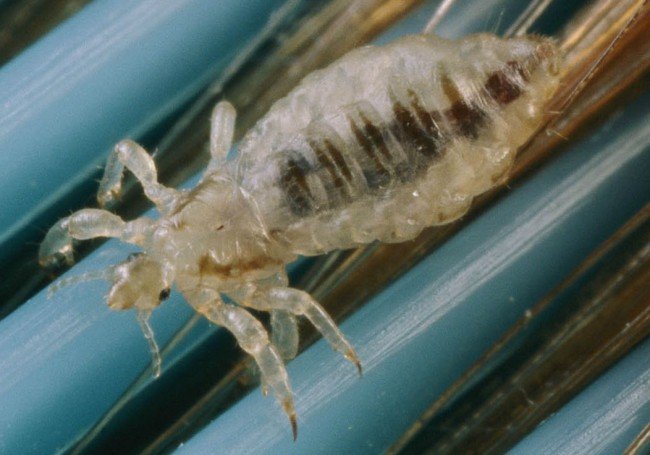 Людські воші – Звідки беруться і як від них лікуватися (фото)