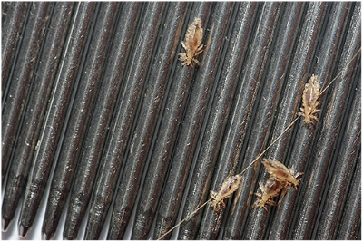 Воші – як позбутися і вилікувати педикульоз?