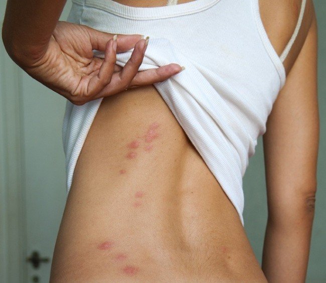 Як позбутися від клопів у квартирі — швидко і без наслідків