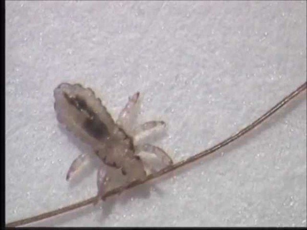 Білизняні воші: симптоми, засоби боротьби і лікування