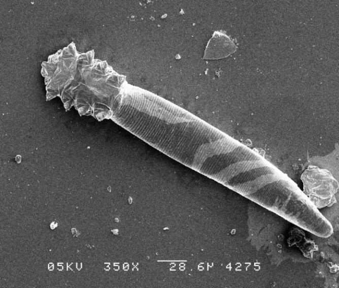 Підшкірний кліщ у кішок   чим небезпечний і як лікувати