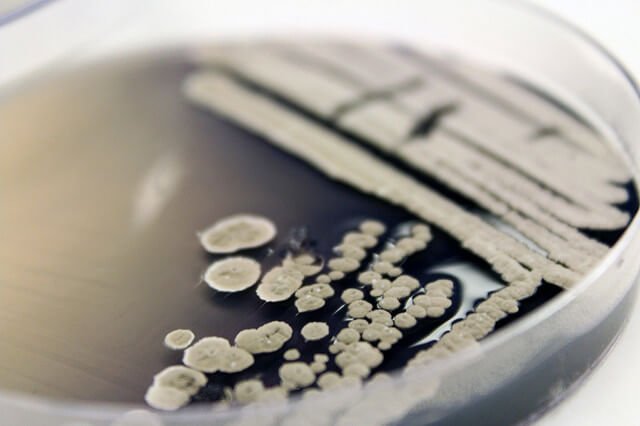 Як вибрати бактерії для септиків і вигрібних ям