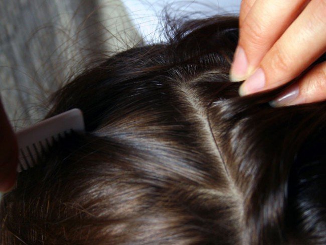 Воші і гниди у дітей — Ефективні поради для батьків