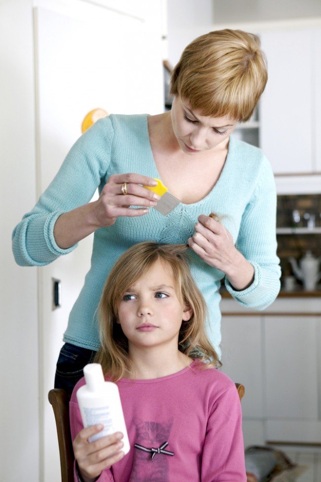 Воші і гниди у дітей — Ефективні поради для батьків