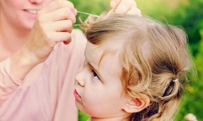 Гниди у волоссі: причини появи і як позбутися Гниди у волоссі: причини появи і як позбутися