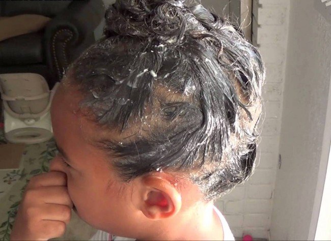 Можуть воші переносити небезпечні хвороби — способи позбавлення від паразитів